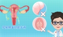 卵巢出血是什么原因造成的 哪些原因会造成卵巢出血
